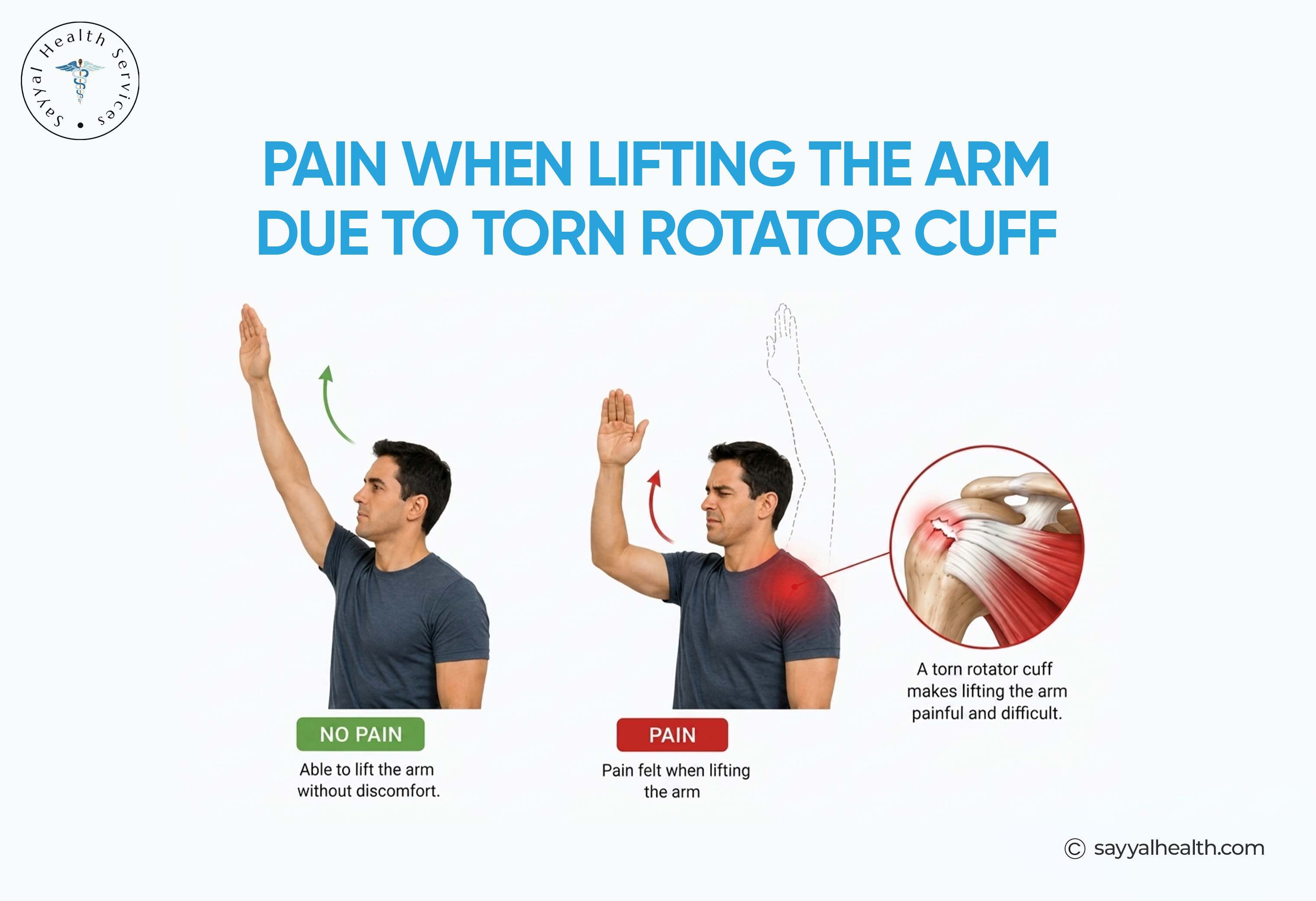 pain when lifting the arm